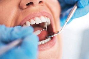 Emergency Dental Services in Grove City: What to Do When You Need Help